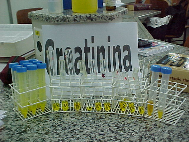 Creatinina 5.JPG (83823 bytes)