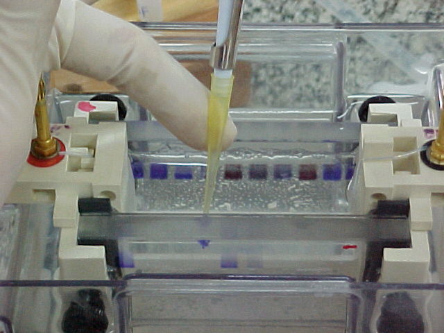 Eletroforese-Pipetagem.JPG (53036 bytes)