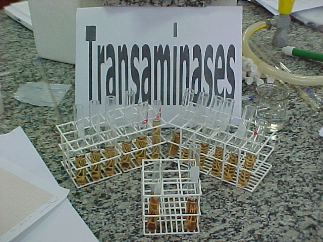 Transaminases 1.JPG (85304 bytes)