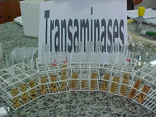 Transaminases 3.JPG (80614 bytes)