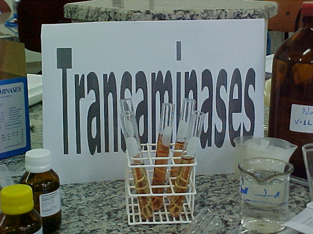 Transaminases 6.JPG (68866 bytes)