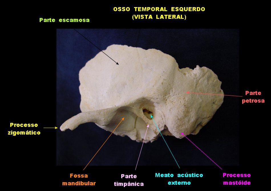 Изменения височной кости. Височная кость анатомия Синельников. Строение височной кости анатомия. Височная кость черепа анатомия человека.